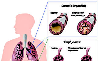 什么是慢阻肺？