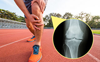 運動會不會造成膝蓋退化？醫師完整解析