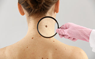 澳洲加入全球首批新型無痛皮膚癌治療試點